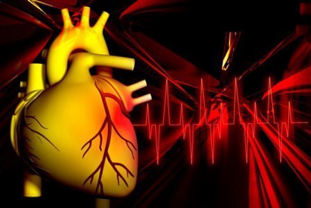 Angina related image